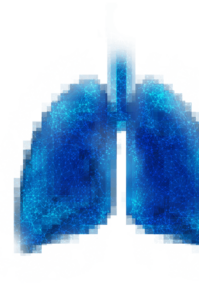 CyPath® Patients | CyPath® Lung